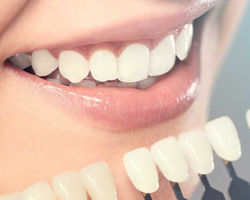 Cosmetic dentistry in Thane West