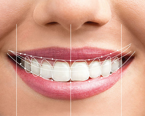 Smile designing in Thane West