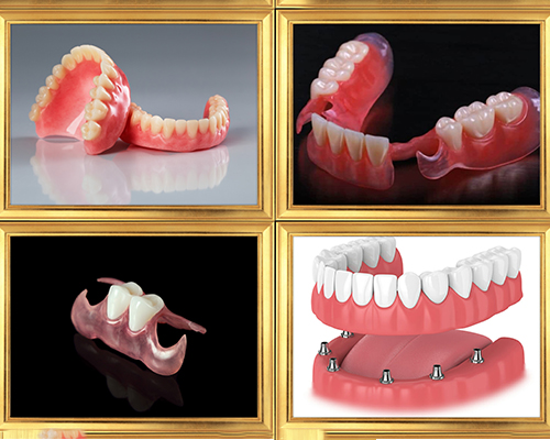 Dentures in Thane West
