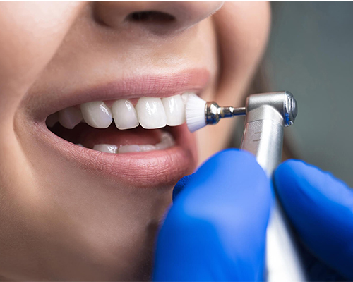 Dental cleaning and polishing in Thane West